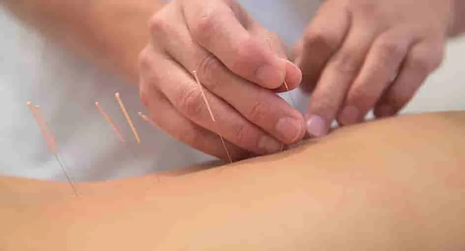 Los beneficios de la acupuntura para la salud y el alivio de diversas afecciones.